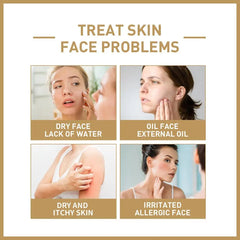 Rice Essence Toner 150ml Glow Essence with Niacinamide Hydrating for Dry Skin Facial Skin Care Daily Skincare Toner