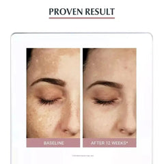 Cleansing Foam Makeup Remover Whitening Acne Facial Care Oil Control Cleanser Travel Size